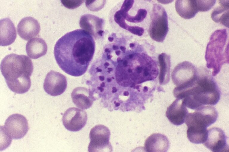 Leishmaniose visceral: estudo de SP desenvolve teste para nova espécie de parasita Leishmaniose visceral: estudo de SP desenvolve teste para nova espécie de parasita