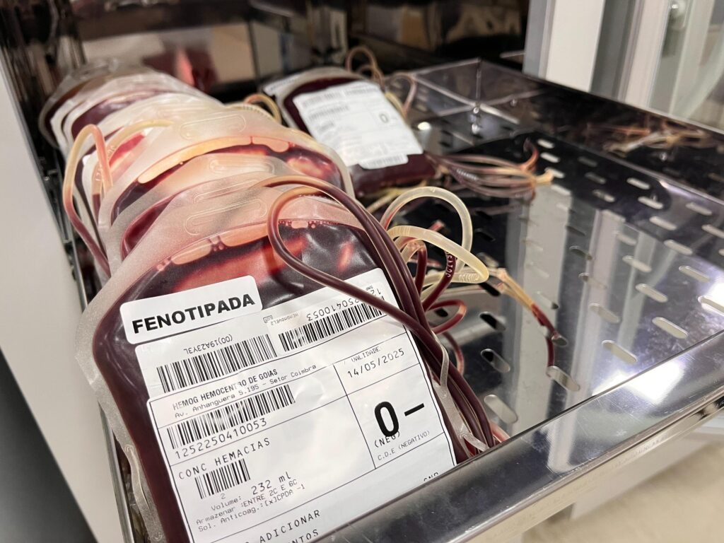 Doacao-de-sangue-na-Rede-Hemo_Alex-Maia